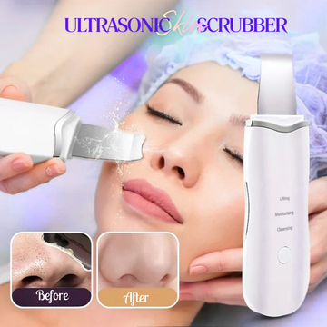 Ultrasonic Skin Scrubber Ance Pore Cleaner Peeling Blackhead Remover
